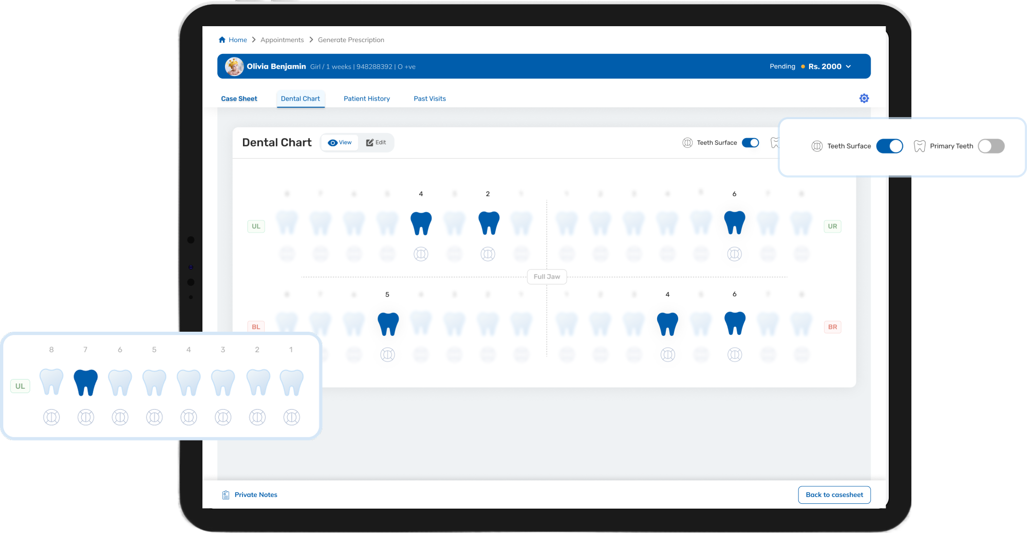 Advanced Dental Charting
